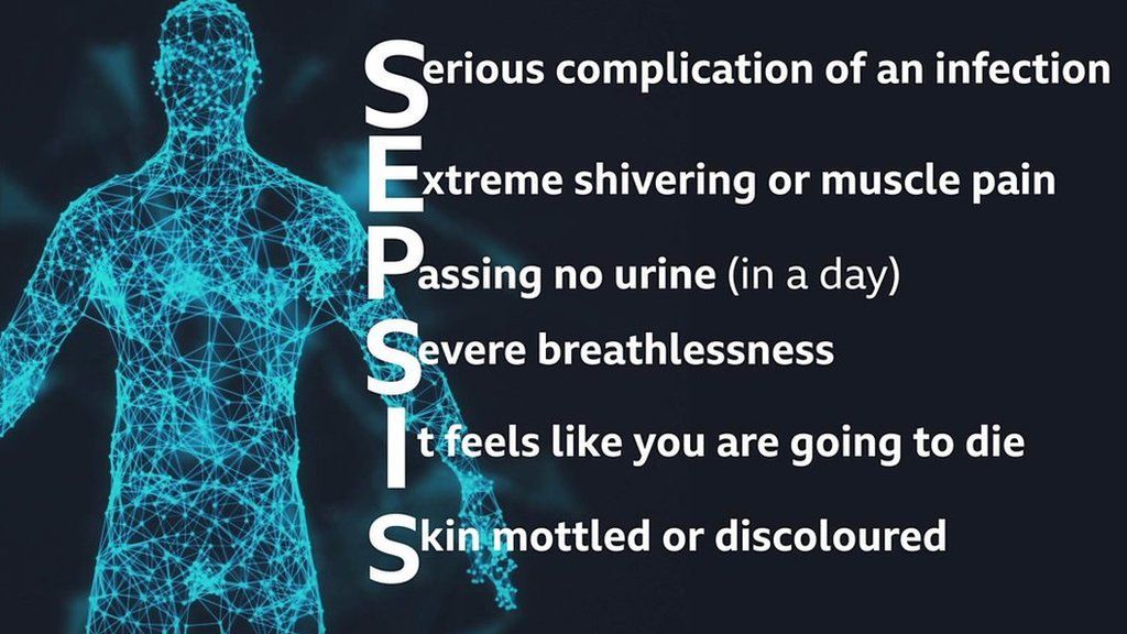 Sepsis - infographic on symptoms of the illness