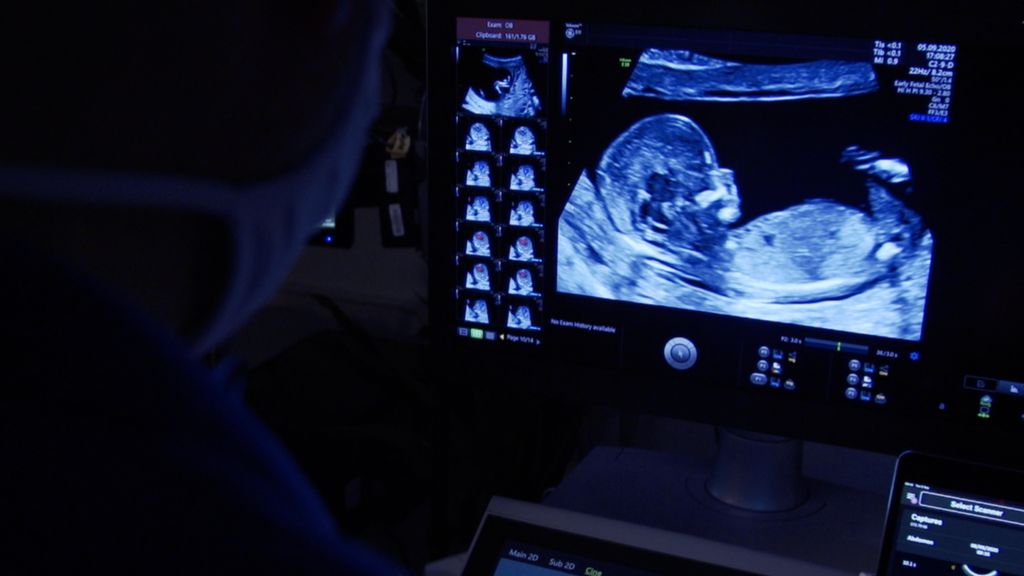 Private baby scans show 'incredibly poor practice' BBC News