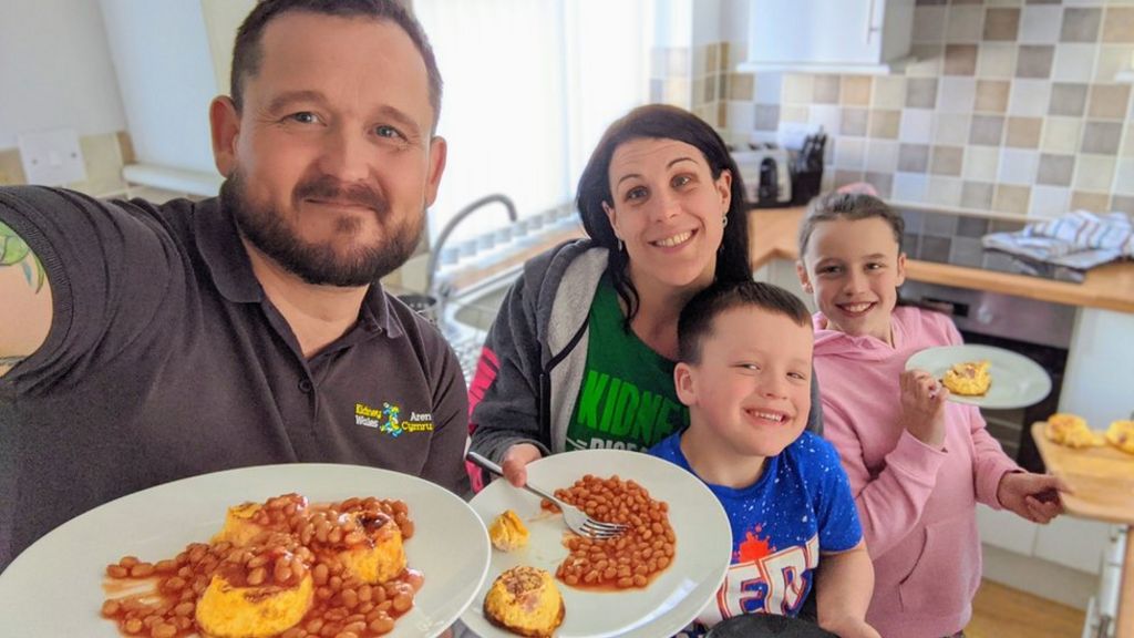 Coronavirus Kidney transplant patients 'in limbo' BBC News