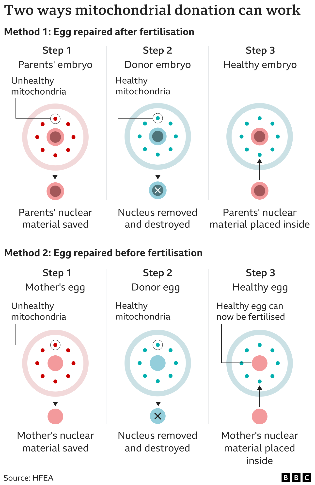 Graphic showing the two ways mitochondrial donation can work: with the nuclear material taken from the parents' unhealthy embryo after fertilisation and replacing the nucleus in the healthy donor embryo; or the nuclear material being taken from the mother's unhealthy unfertilised egg and replacing the nucleus in the donor egg ready to be fertilised