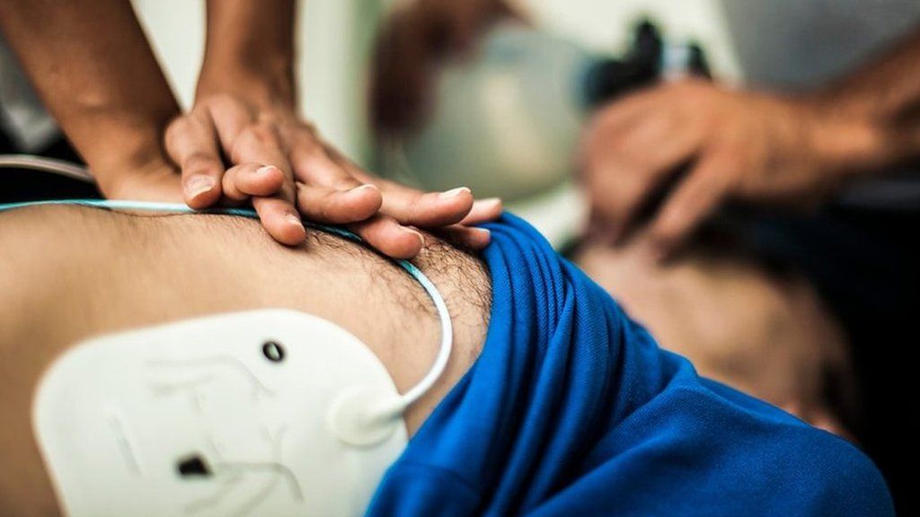 Defibrillator is used on a man