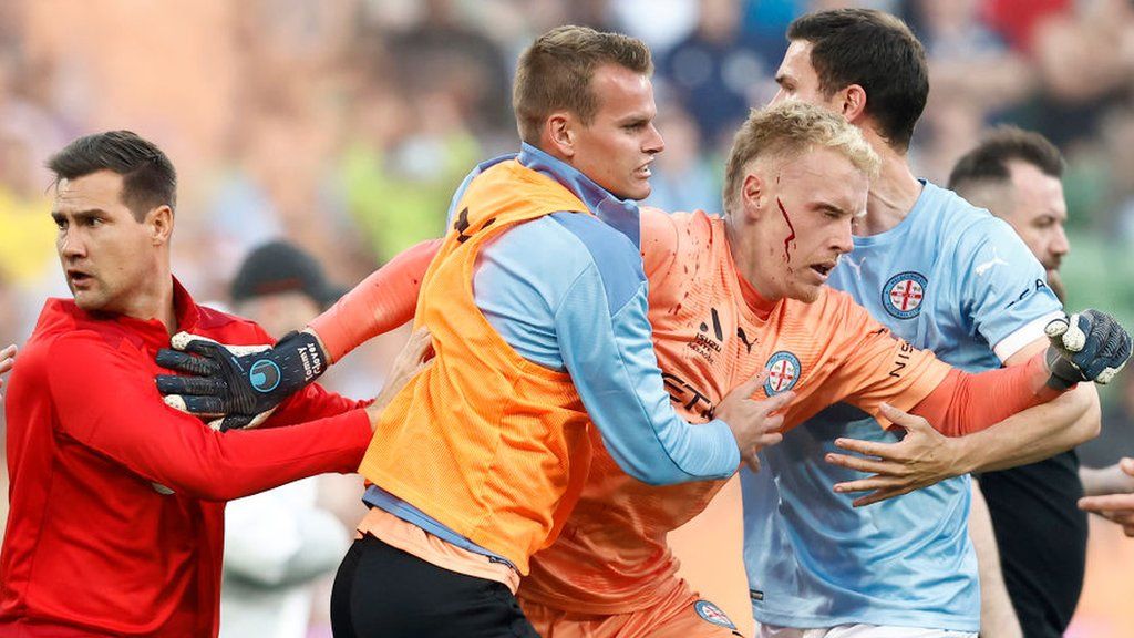 Melbourne City players are ushered from the field after crowd trouble during their game with Melbourne Victory, with goalkeeper Tom Glover having a cut on his face