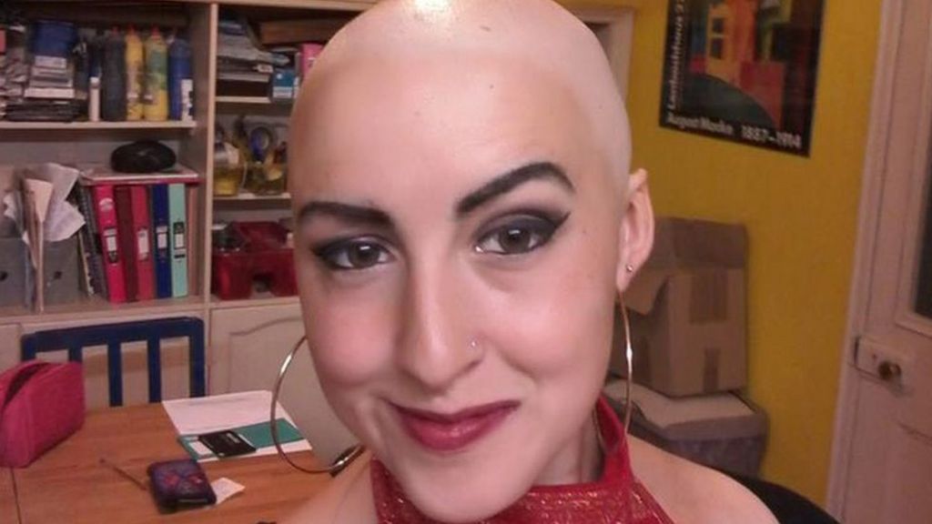 Alopecia Brecon Dancer 25 Tackles Hair Loss Head On Bbc News