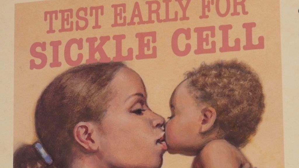 Mother and child on a poster promoting sickle cell testing