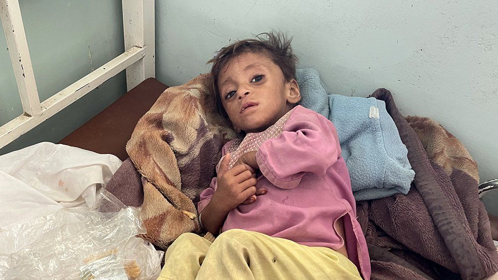 A child receives medical treatment in hospital Kandahar, Afghanistan, October 14 2021