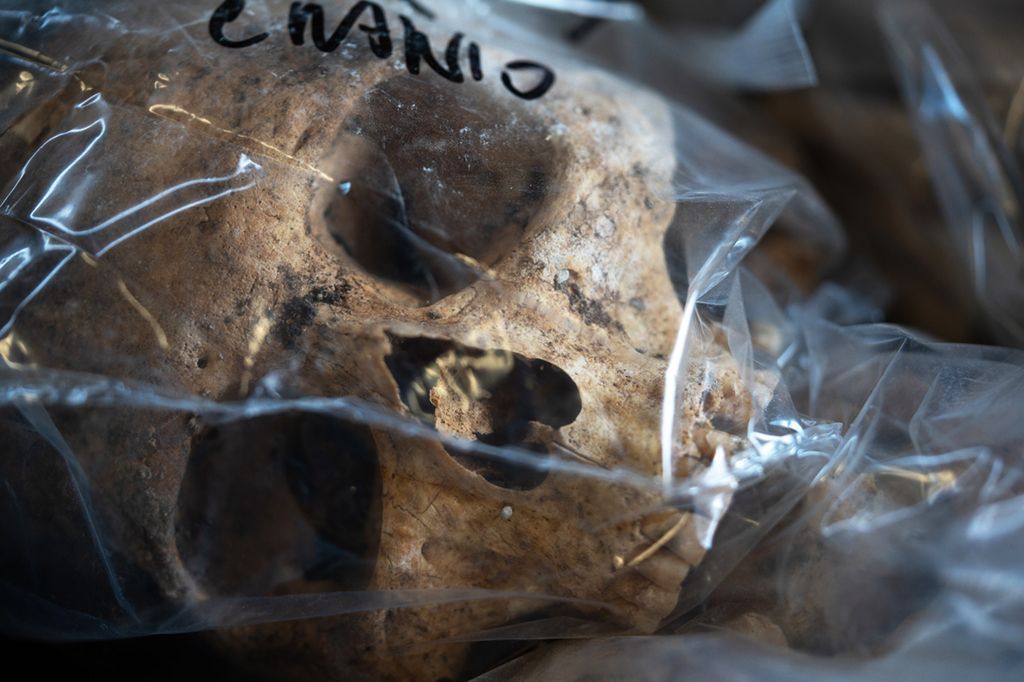 A human skull stored in a plastic bag