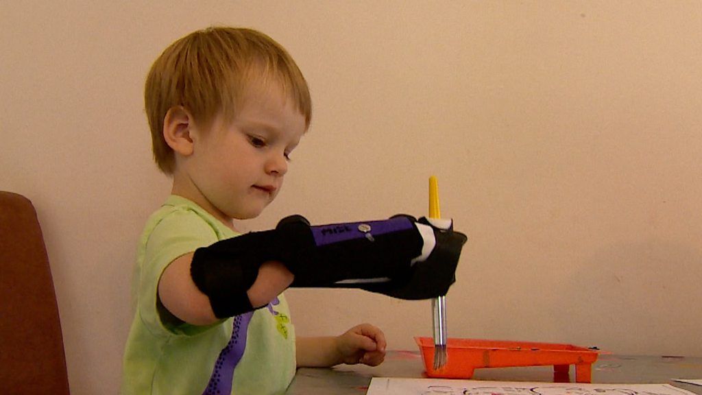Hero, 3, using her prosthetic arm to paint