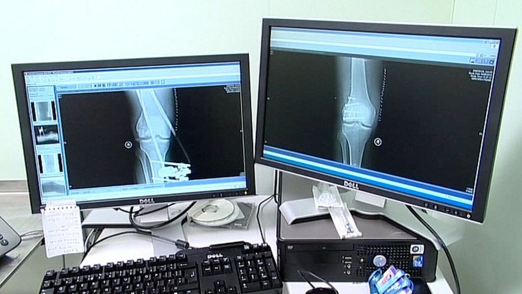 Quarter Of Radiologist Posts In Northern Ireland Vacant Bbc News
