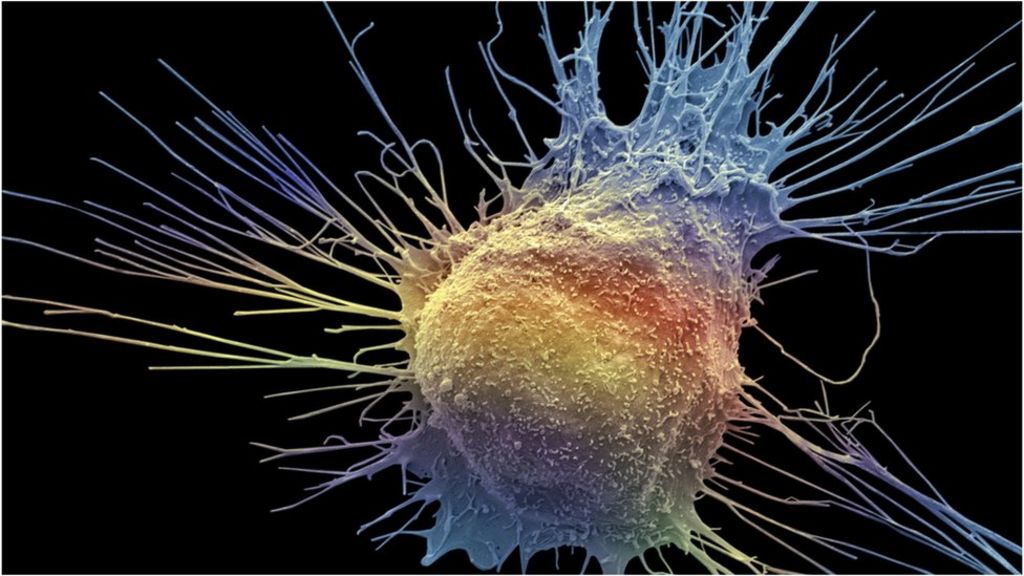 Prostate cancer treatment 'could help more patients'