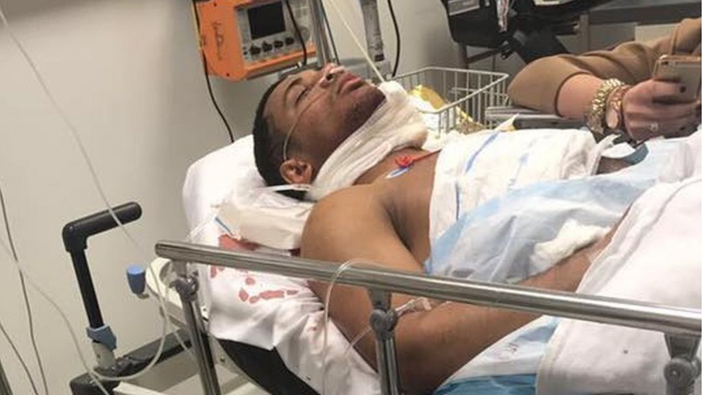 Irish amateur boxer Hynes stabbed in face on night out