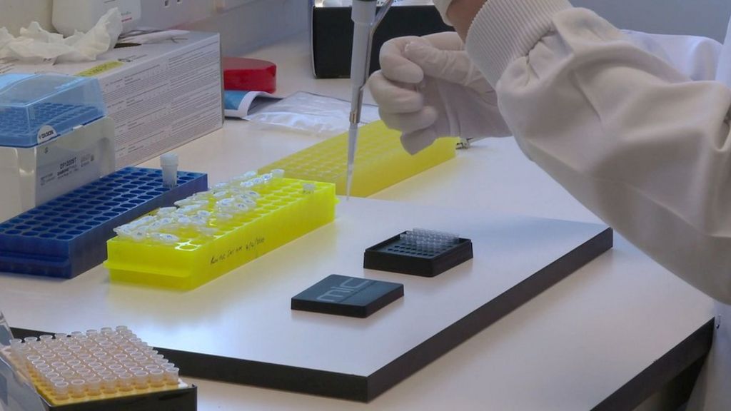 Covid19 Second case identified in Guernsey with 'unknown' origin