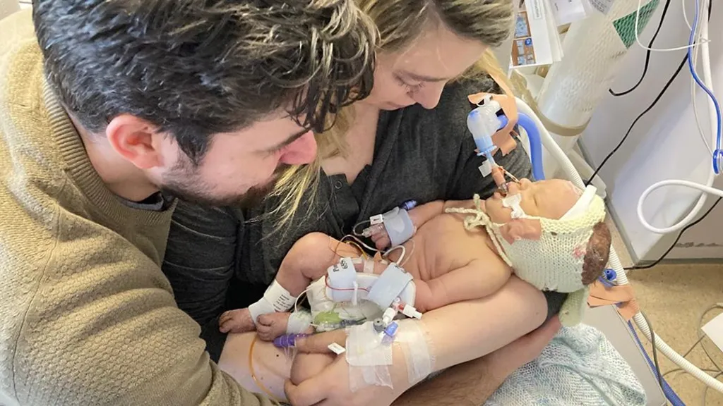 Sophie and Joe gently hold a newborn in a hospital environment. The baby wears a knitted cap and is connected to multiple medical tubes and sensors, surrounded by monitoring equipment, highlighting the seriousness of the infant’s condition and the parents’ closeness.