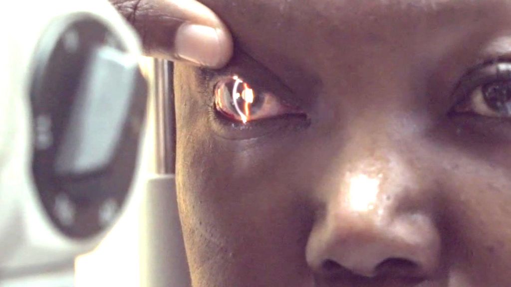 The flying eye hospital