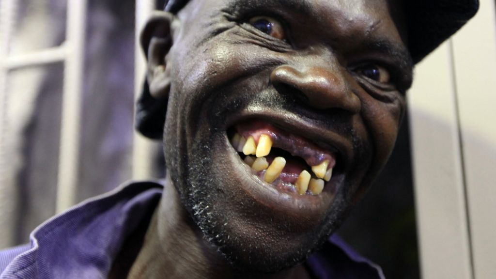 world's ugliest teeth