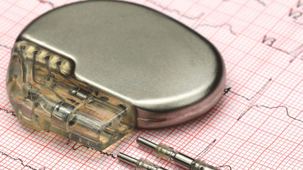 Judge rules pacemaker data admissible in court