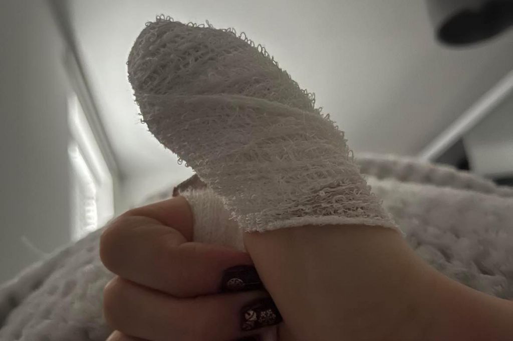A thumb in a bandage