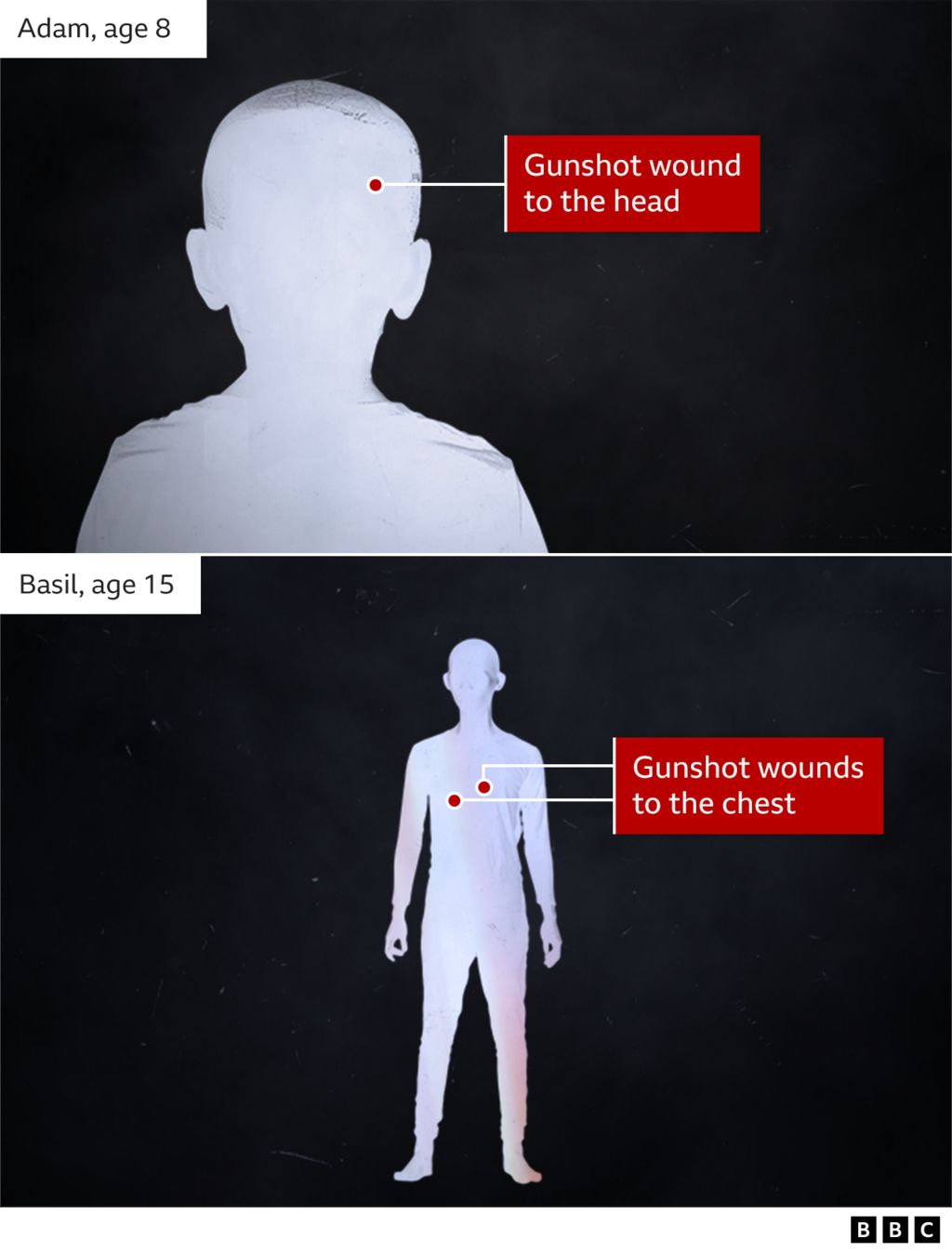 Graphic showing where Adam and Basil were hit by gunshots