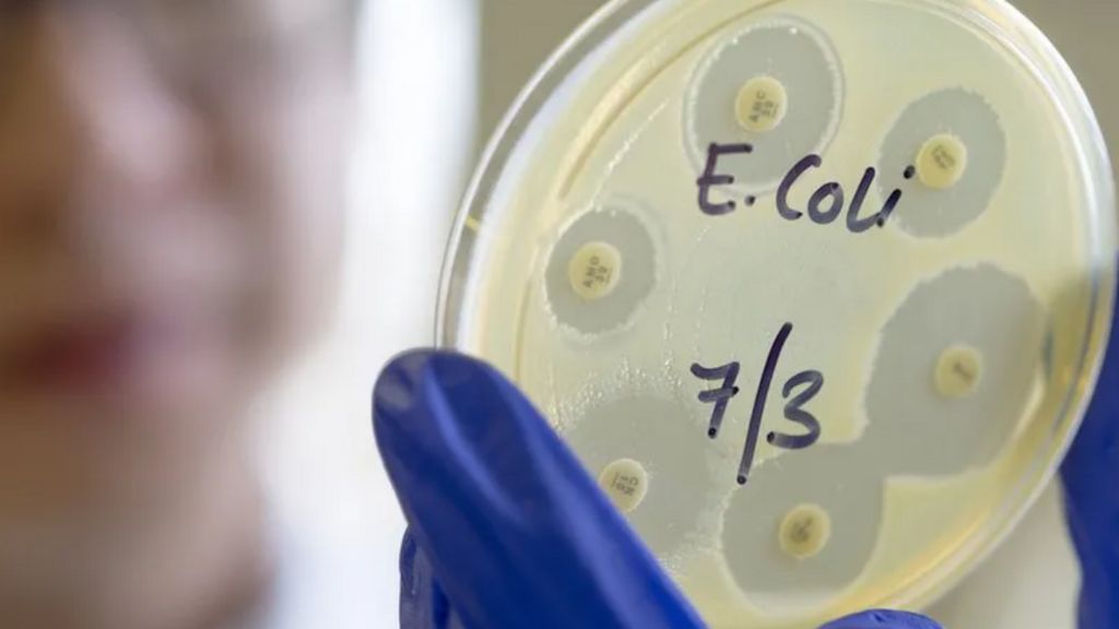 a petri dish marked E. coli