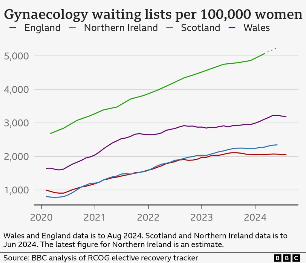 A chart showing gynaecology waits per 100,000 women. The figures are 2,055 per 100,000 in England, 2,345 per 100,000 in Scotland and 3,187 per 100,000 in Wales. Northern Ireland's figure of 5,248 per 100,000 is an estimate.