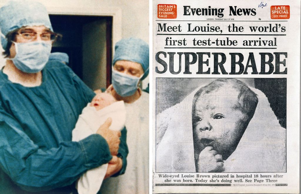 Louise Brown is seen at birth and on the front of a newspaper