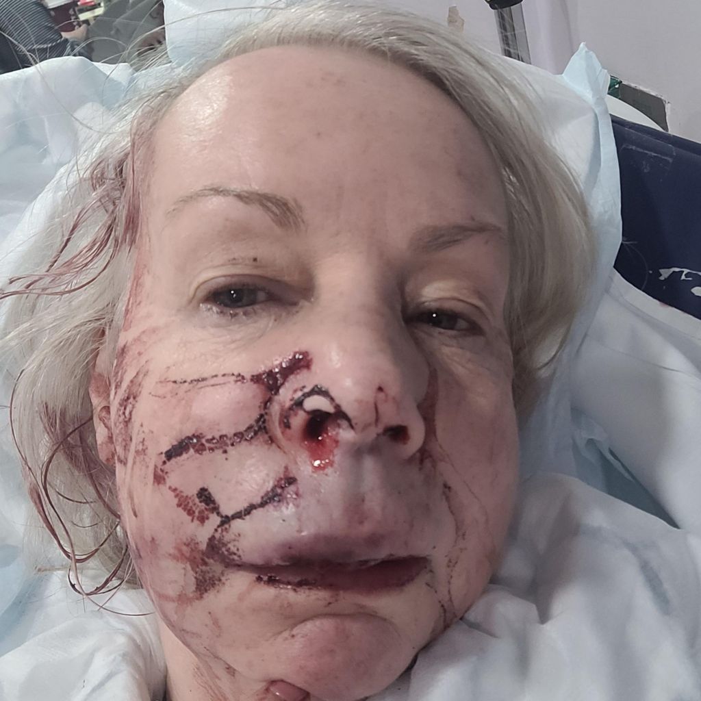 A woman with a bloody face