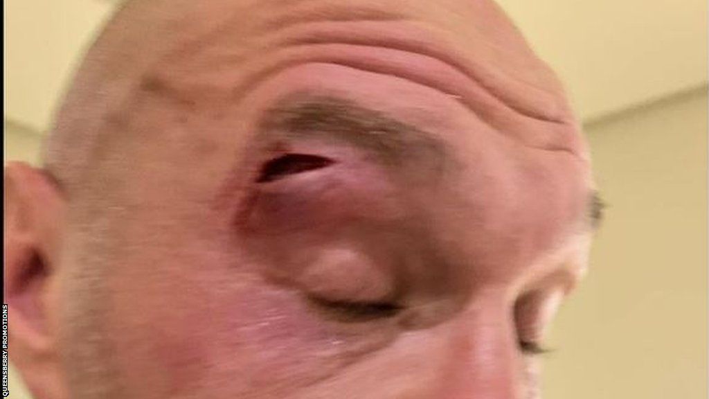 Picture of Tyson Fury's eye injury