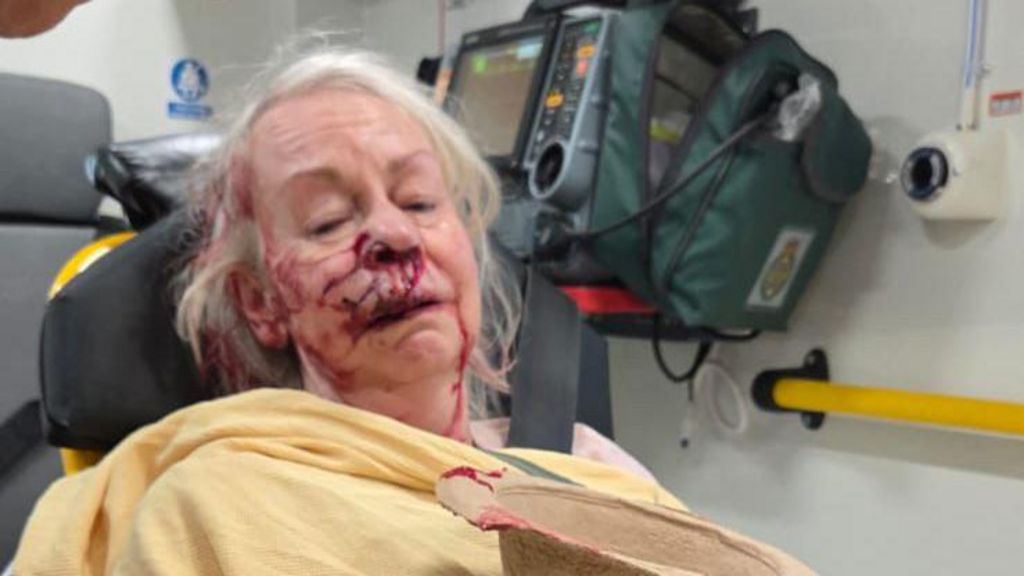 A woman with blood on her face is in the back of an ambulance