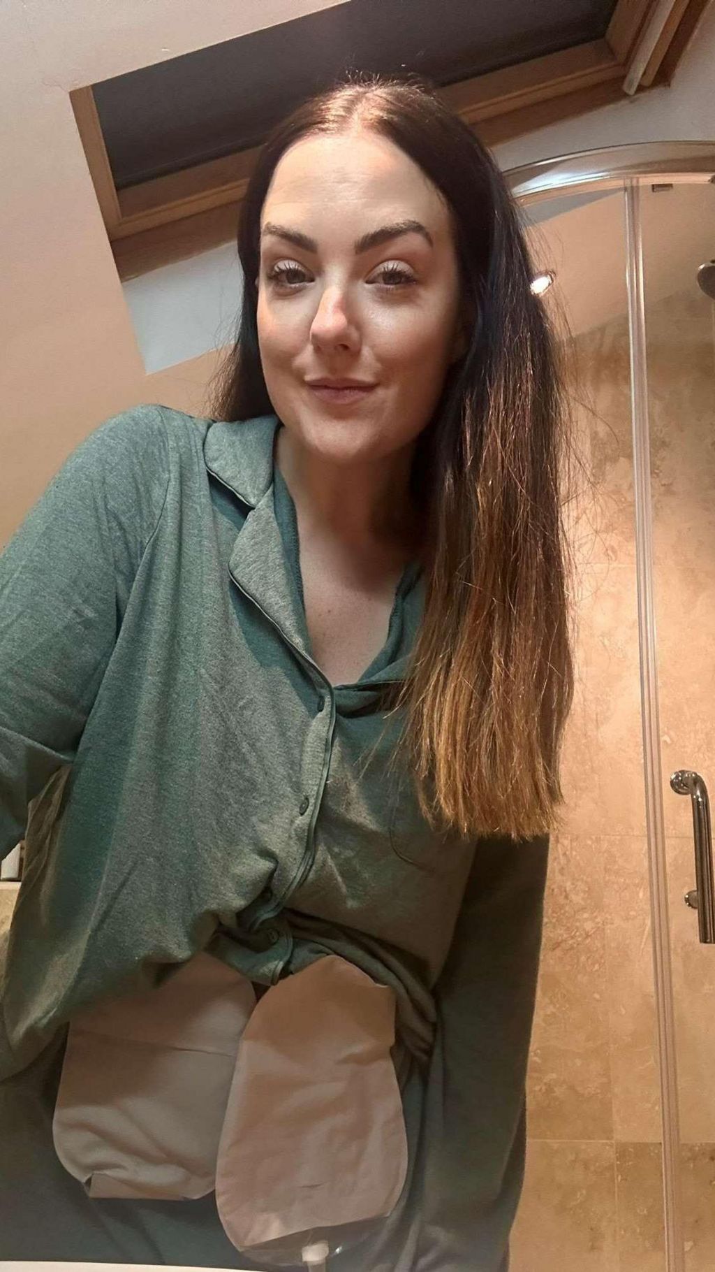 Selfie of 31-year-old lady looking at the camera in a bathroom. She is wearing a green shirt and visible above it are two pale-coloured stoma bags.