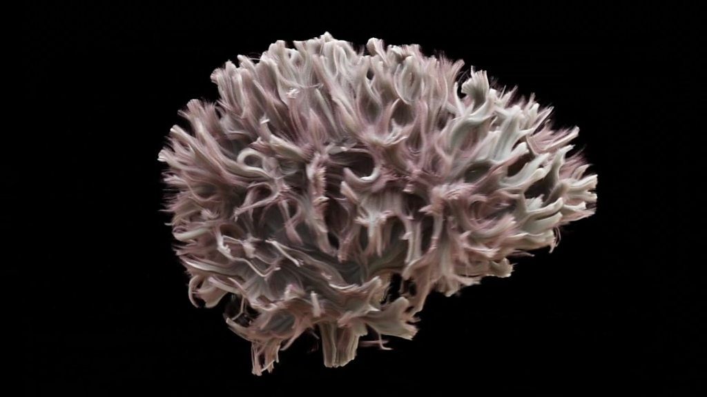 The most detailed scan of the wiring of the human brain BBC News