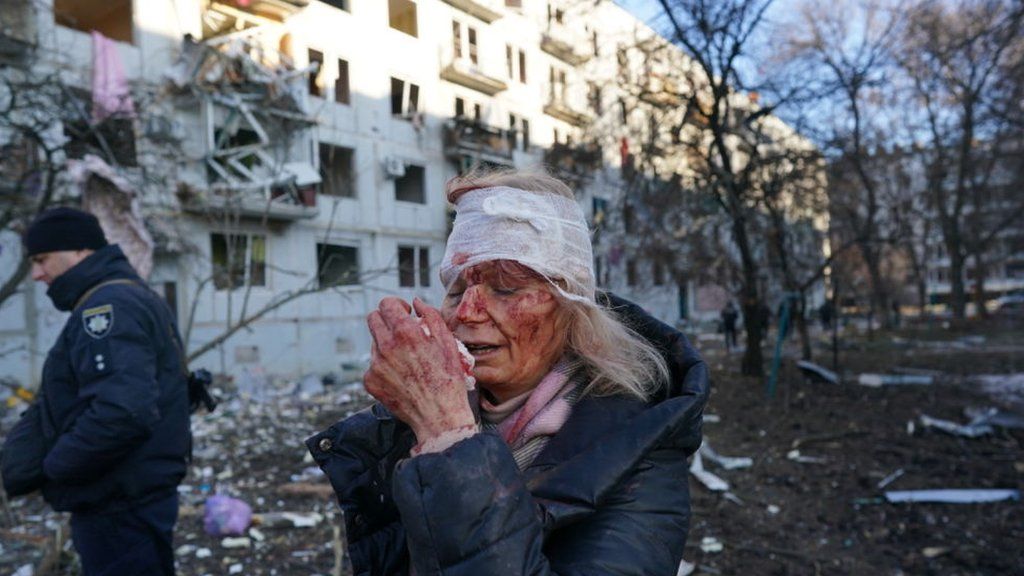 wounded woman, Kharkiv