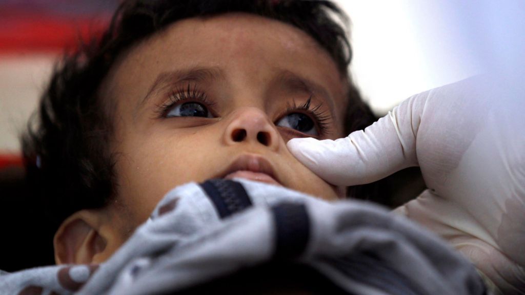Yemen cholera cases pass 100,000 amid 'unprecedented' epidemic