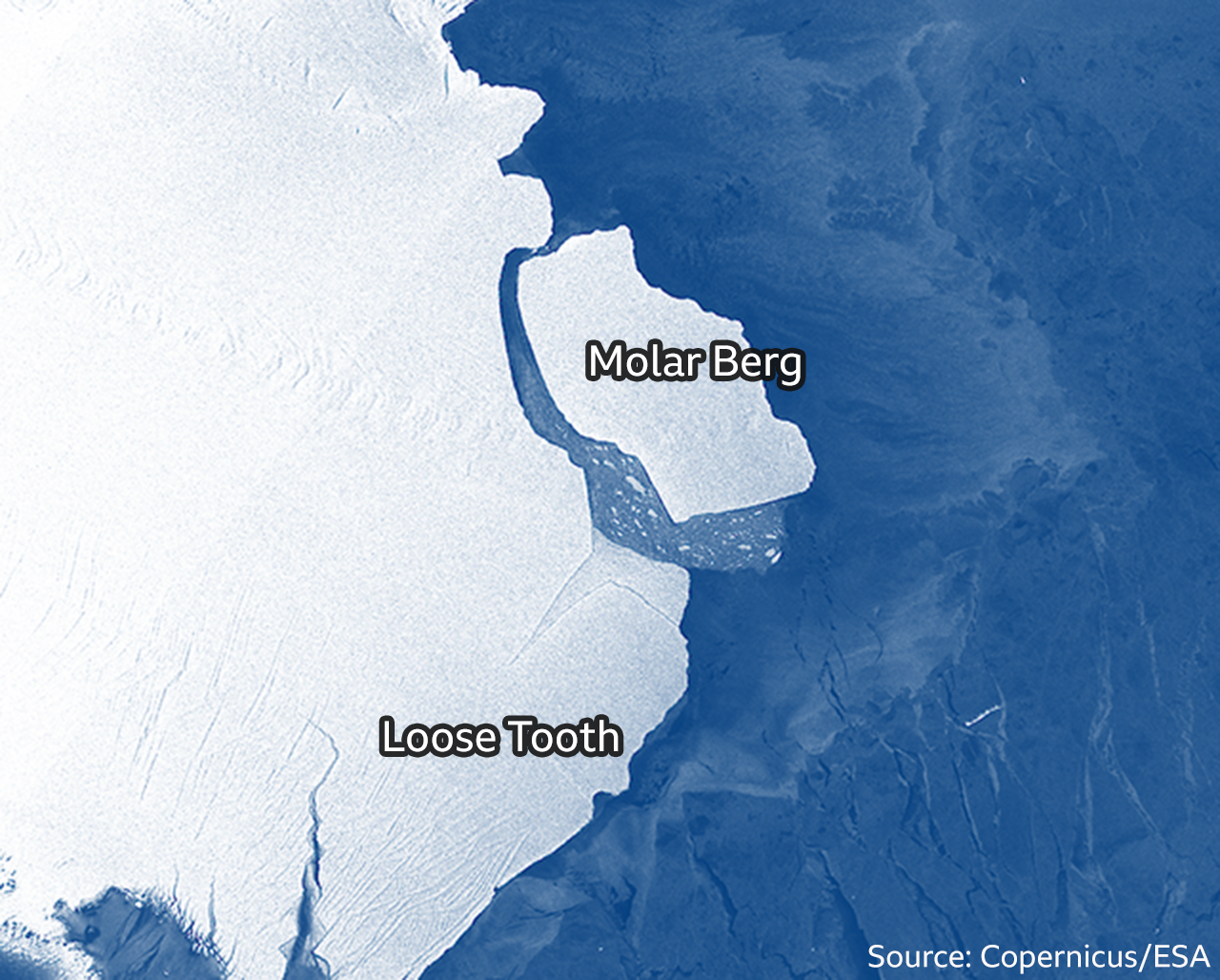 Molar Berg and Loose Tooth