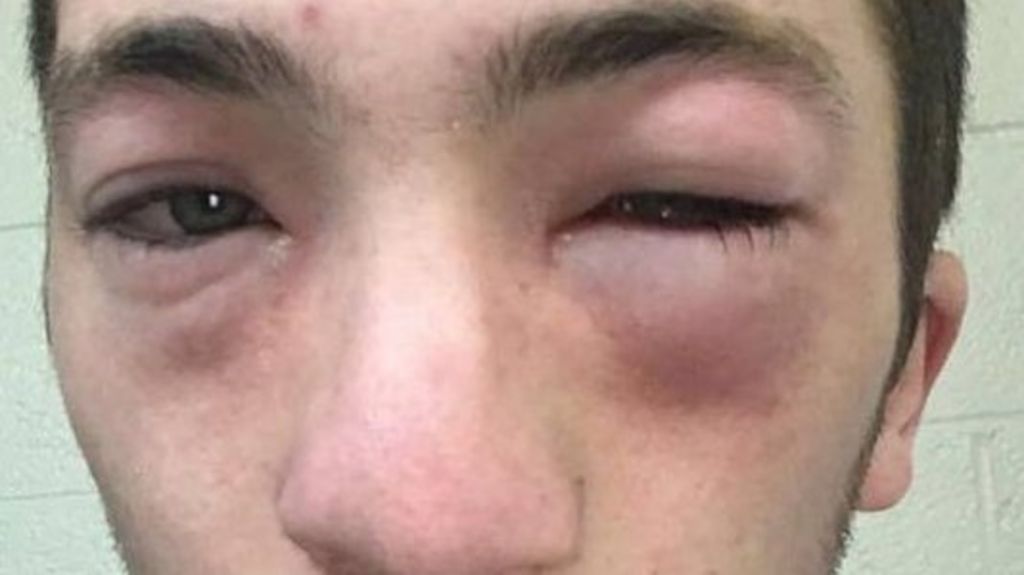 Michigan student charged in 'peanut butter hazing'