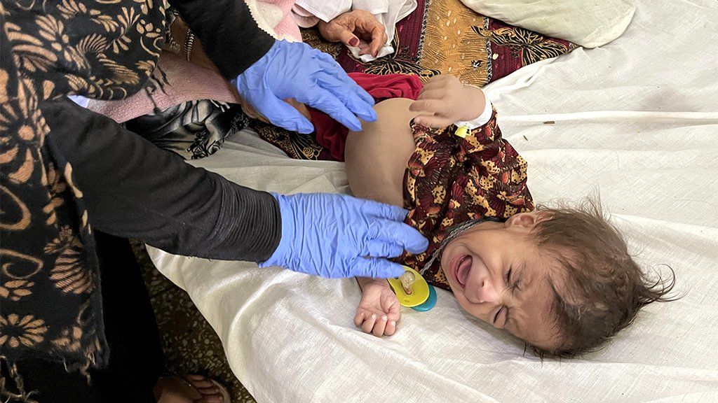 A child receives medical treatment at the Mir Veys Hospital in Kandahar, Afghanistan, October 28, 2021