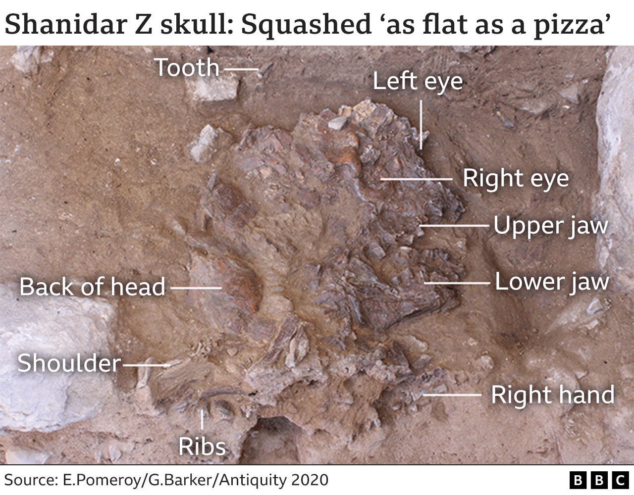 Graphic of Shanidar Z skull