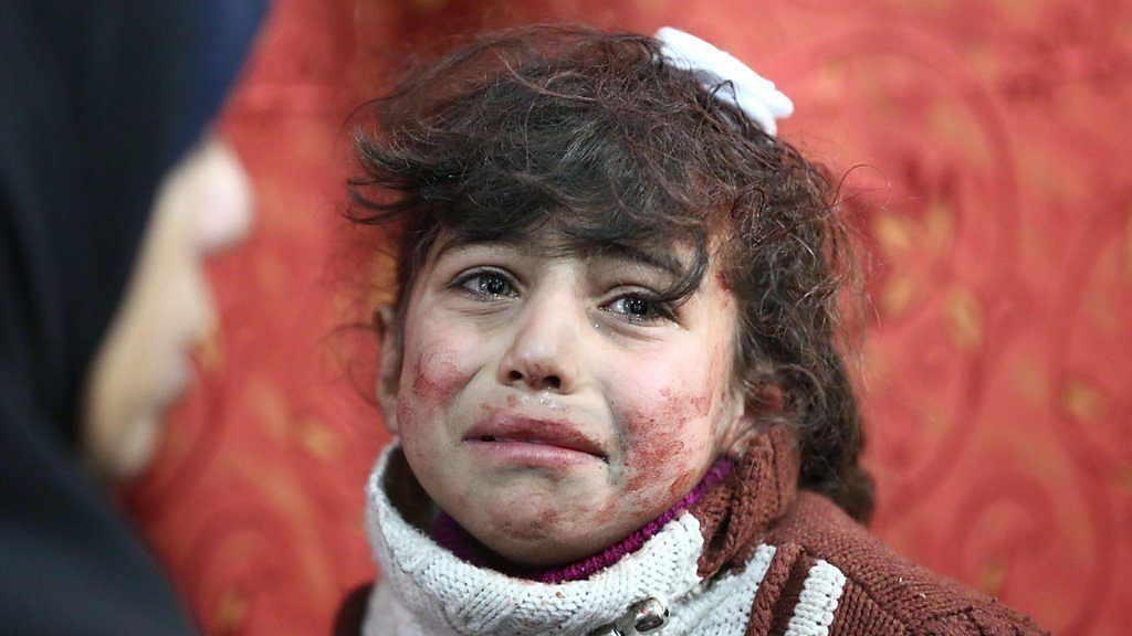 Child in Eastern Ghouta