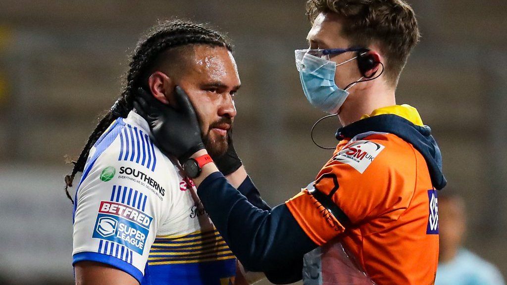 Mouthguards aid rugby league's concussion fight BBC Sport