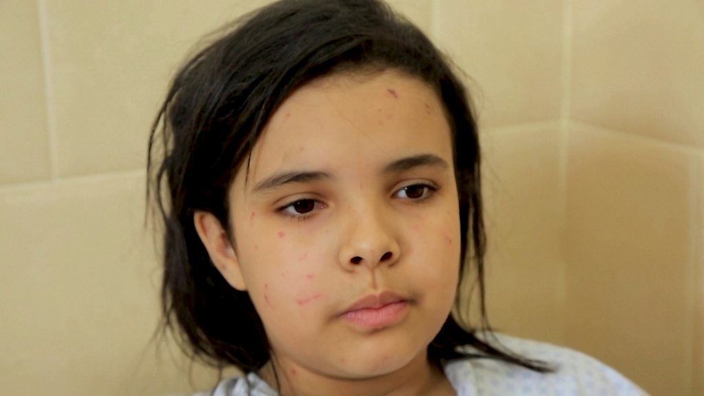 Nine-year-old Leen Matar in hospital
