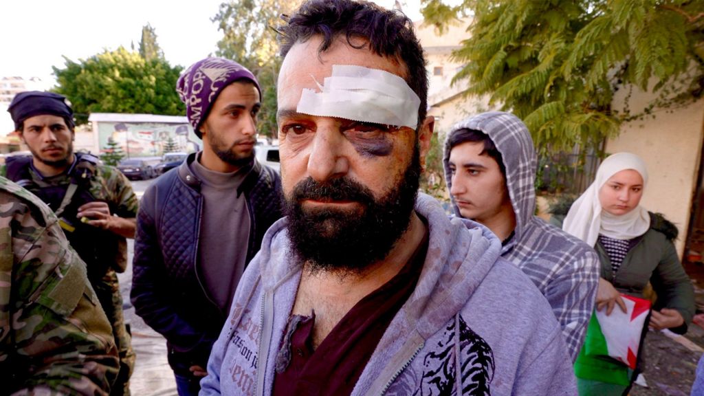 Injured man