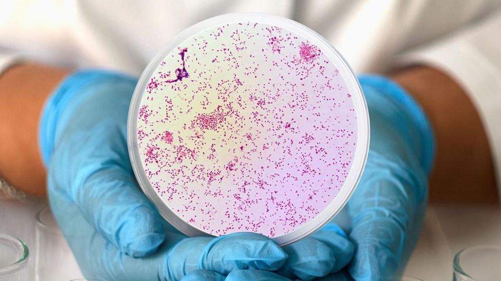 A person wearing blue medical gloves holds a circular frame from a microscope containing Neisseria gonorrhoeae, the bacteria that causes gonorrhoea.