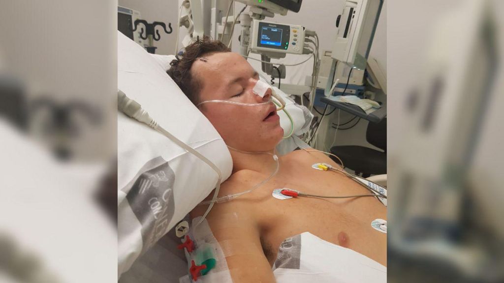 Conor Blundell lying in a hospital bed with medical tubes attached to him