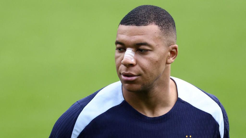 Kylian Mbappe attends a training session with a white bandage across the bridge of his nose