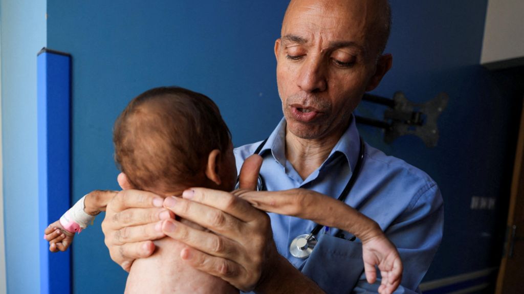 Palestinian doctor Ahmed Basal lifts a small baby as he checks for signs of malnutrition at Al-Rantisi Hospital in Gaza City, on August 7. The child is facing towards the doctor, and their arms are extremely thin with a bandage on one wrist. The doctor's hands appear huge encircling the child's small shoulders. He is wearing a blue shirt and a stethoscope.