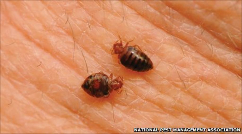 The bedbug summit - banishing the itchy insects - BBC News