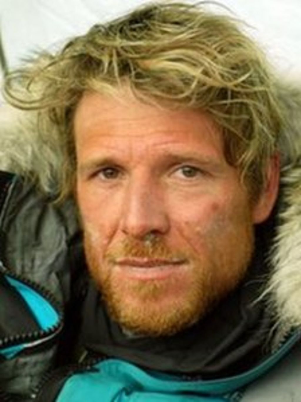 Olympic rower James Cracknell tells of injury cost BBC News