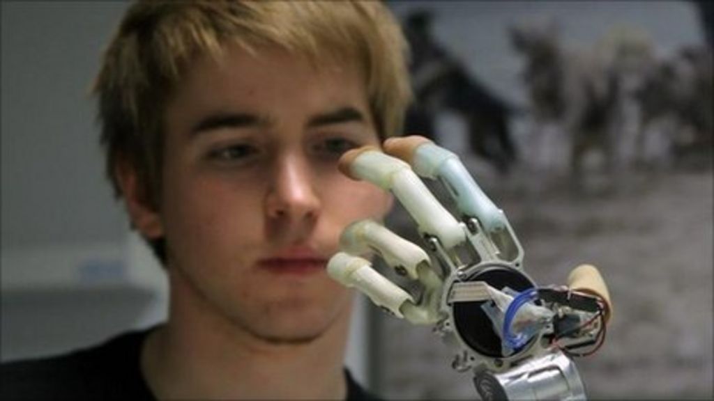 Amputee Patrick demonstrates his new bionic hand - BBC News