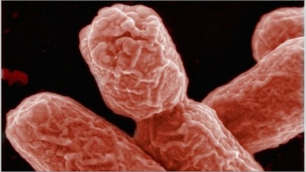 Q&A E. coli outbreak BBC News