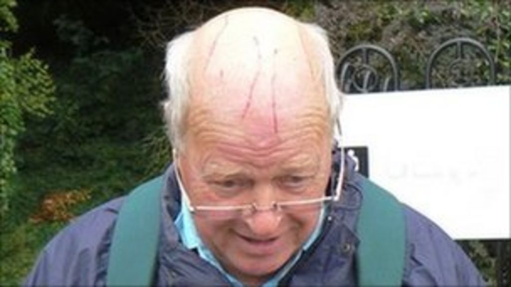 Man 71 Attacked By Buzzard In Field Near Severn Stoke Bbc News