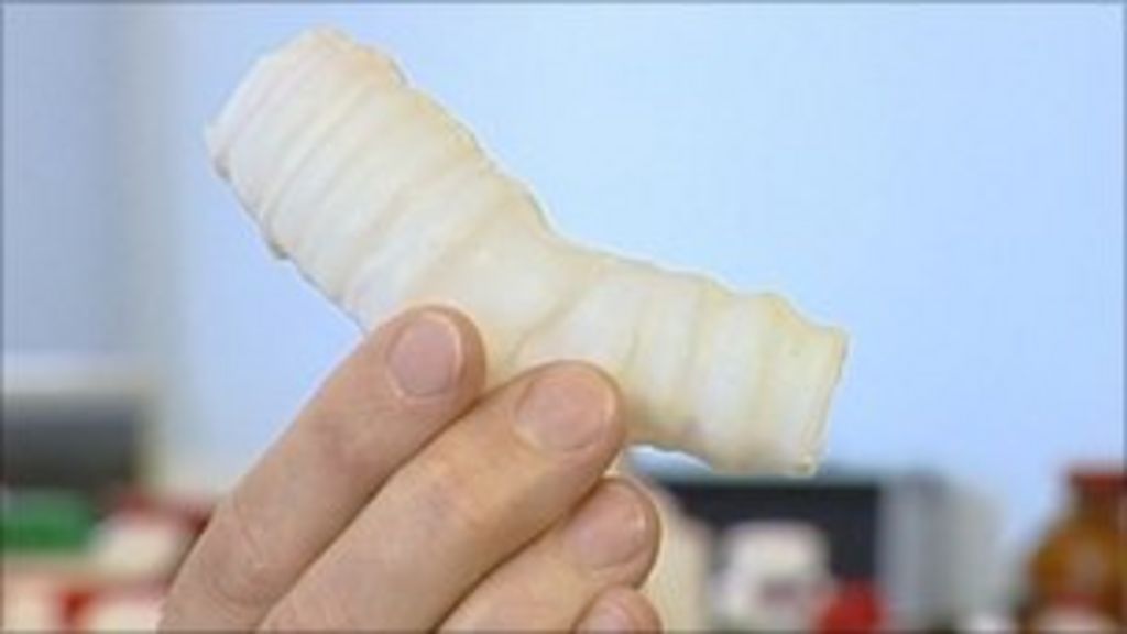 First synthetic organ transplant BBC News