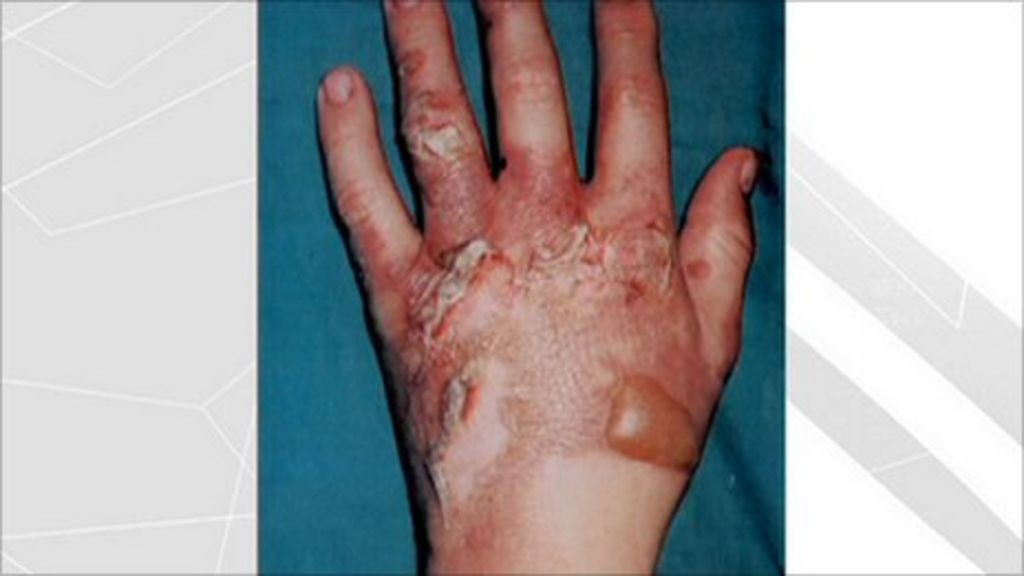 Railway electric shock victim in danger warning BBC News